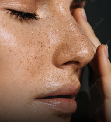 Close-up of a woman's face with clear, healthy skin, emphasizing the benefits of Omni-Biotic probiotics for women