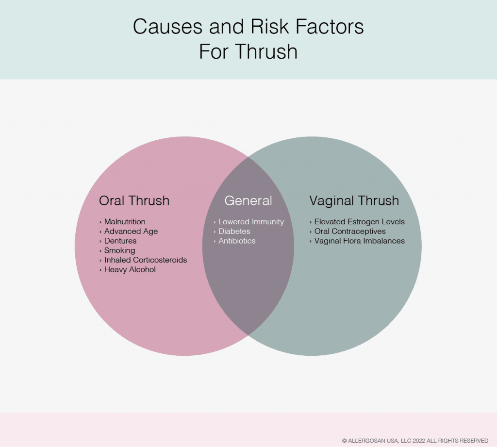 causes and risk factors for thrush