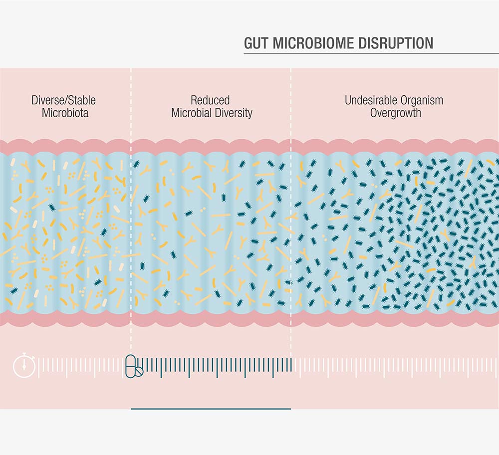 Diagram showing gut microbiome disruption, with sections for diverse/stable microbiota, reduced microbial diversity, and undesirable organism overgrowth